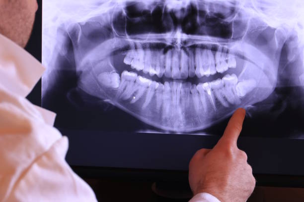 Best Emergency Treatment for Oral Infections in Saint Davids, PA
