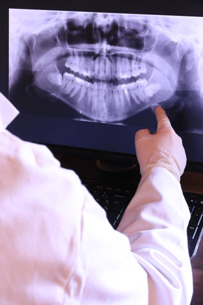 Best Emergency Dental Care for Sports Injuries in Saint Davids, PA